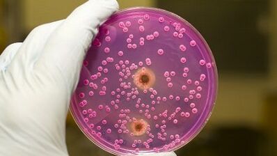 Descarga patolóxica nos homes cando está emocionada